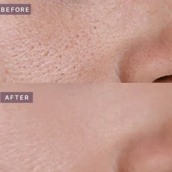 Pot Pore Tightening Podo Ampoule